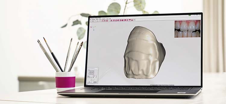 ceraMotion&reg; CADback – &iexcl;el software creativo para ceramistas!