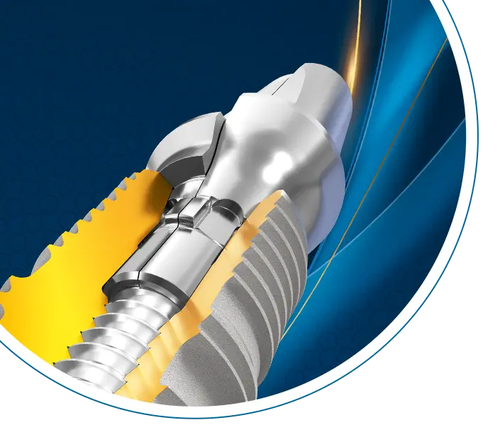 tioLogic&reg; TWINFIT